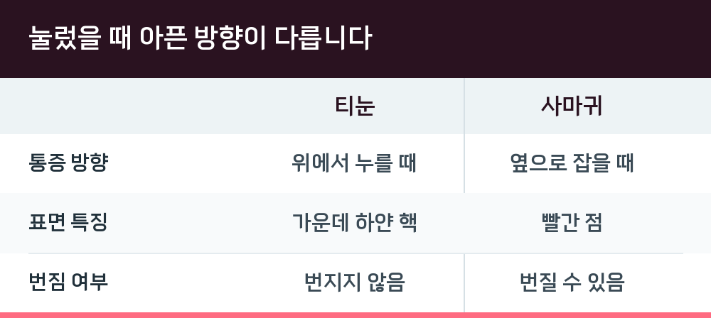 눌렀을 때 아픈 방향이 다릅니다
