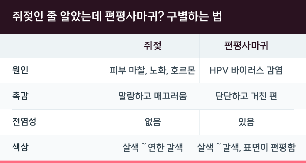 쥐젖인 줄 알았는데 편평사마귀? 구별하는 법